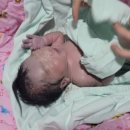 더블유 여성병원 이미지