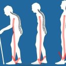 척추가 중심 이미지