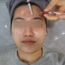 천안 청담동 피부관리 🫧 가인뷰티 에스테틱 여드름압출 후기 🔺️