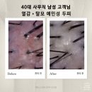 더리터서신여울점 | 전주 탈모 치료 관리 헤드스파k전주서신점 두피케어 관리 스트레스푸는법 내돈내산