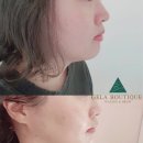 충주난 이미지