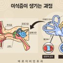 부산하나이비인후과 네이버블로그