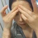 에스플러스이앤디(주) | 집에서도 에스테틱 받은 듯, 에슬 PLLA 링클크림 사용후기 “PLLA 팔자주름크림