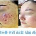 아름다온뷰티 네이버블로그