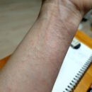 하늘샘약국 | 코로나19 백신 화이자 2차 접종 후기(부스터 샷 및 카카오 QR코드 증명서)-일산 덕이동 아이산 산부인과