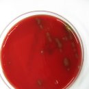 Streptococcus pneumoniae 이미지