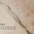 미엘피부관리