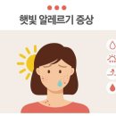 알레르기 이미지