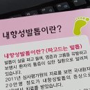 내향성발톱 치료 (파고드는 발톱) 내향성발톱 예방법 이미지