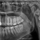 바른인성치과의원 네이버블로그