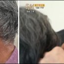 독일보청기 부천원미구청센터 이미지