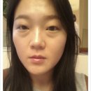 닥터마레산부인과 네이버블로그