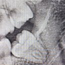 산정치과의원 | [홍대] 사랑이 아프니 치과 -사랑니 2개 발치 (발치 비용 /보험 청구/ 발치 시간/ 관리)