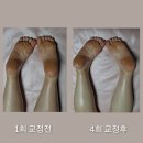 위더스산후케어민낯 | 위더스산후케어 산후마사지 - 시흥안산맘들~ 09.03