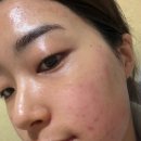 메디셀바이오 | 대구 북구 동천동 에스테틱에서 사용하는 진정수분 마스크팩 추천 메리키트 메디 셀 마스크 후기