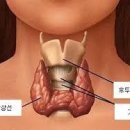 갑상선기능 저하증에 좋은 음식과 피해야 할 음식 이미지