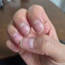 네일바름 | 20대 간호사 손톱 갈라짐 해결템 찾는다면｜바름 네일 앤 큐티클 리페어 에센스 오일 펜 후기