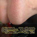 광주 패디플래닝 발각질 제거 여름준비 완료 후기