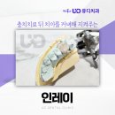 유디치과빌딩 | 인레이 골드 vs 치아색 어떤 재료로 진행할까요? 개금역치과