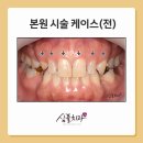 트윈치과기공소 네이버블로그
