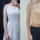 황금약국 | 여름대비 다이어트추천 지방추출 3개월차 찐황금후기 (멍, 붓기, 통증 등 총정리)