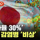 일본 여행 가도 되나?..日 ‘치사율 30%’ 감염병 급증 “지금까지 없던 일” 이미지