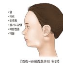 길랑바레증후군 길랑 바레 증후군 원인 법 이미지