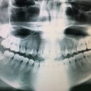 화순치과의원 이미지