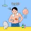 D00483 | 피부과 전문의와 알아보는 대상포진의 모든 것(feat. 예방접종)