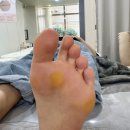 리턴투뷰티 | 광주 수완지구 발각질정리 전문 리턴투뷰티 패디플래닝 후기
