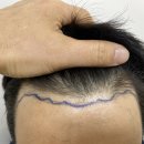 모바른의원 이미지