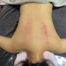 전주 피부관리 : 송천동 온결 에스테틱 등관리 후기