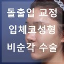 돌출입 교정과 입체 코성형, 그리고 비순각 수술 효과