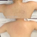 오로라 피부관리