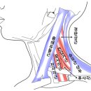 참을 수 없는 두통!! 이미지