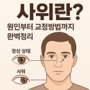 상지안경 | 서울 경기도 수직사위 교정안경 프리즘 렌즈 효과와 실제 사례