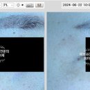 오아로피부과의원 청량리 네이버블로그