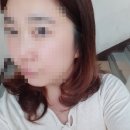 아이디헤어라페 이미지