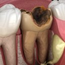 탑티어치과의원 이미지