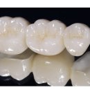 이유 치과기공소 이미지