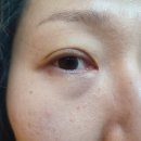 뉴서전안경원 이미지