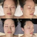 수원-1190 | 수원 웨딩관리 성지 [수봄에스테틱 수원인계점] 윤곽관리 후기