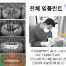 평동치과의원 | 수원 권선구 임플란트 치과 추천 5곳 (상담전 알고가면 좋은 주의사항 )