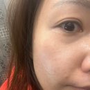 아임케어 | 선크림 바르는 좋은 습관 / 색소침착케어 5회 관리 탄력관리까지 후기 [아임뷰티]