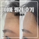 이마 | 이마 필러 후기 7cc 내돈내산 후기 12일 동안 통증·붓기·만족도 기록
