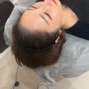 [부산두피문신]두피문신SMP란?서면 헤어라인 두잉크 마지막 3차후기