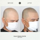 스칼프디자인센터 네이버블로그