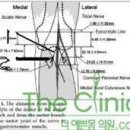 Re:종아리근육퇴축술,특히 비절개선택적신경차단술 안전성및 우수성(사진) 이미지