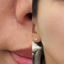 더라움의원 이미지