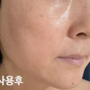 소이담 | 속부터 차오르는 탄력! 3중 탄력 세럼 소이담 리얼 사용 후기